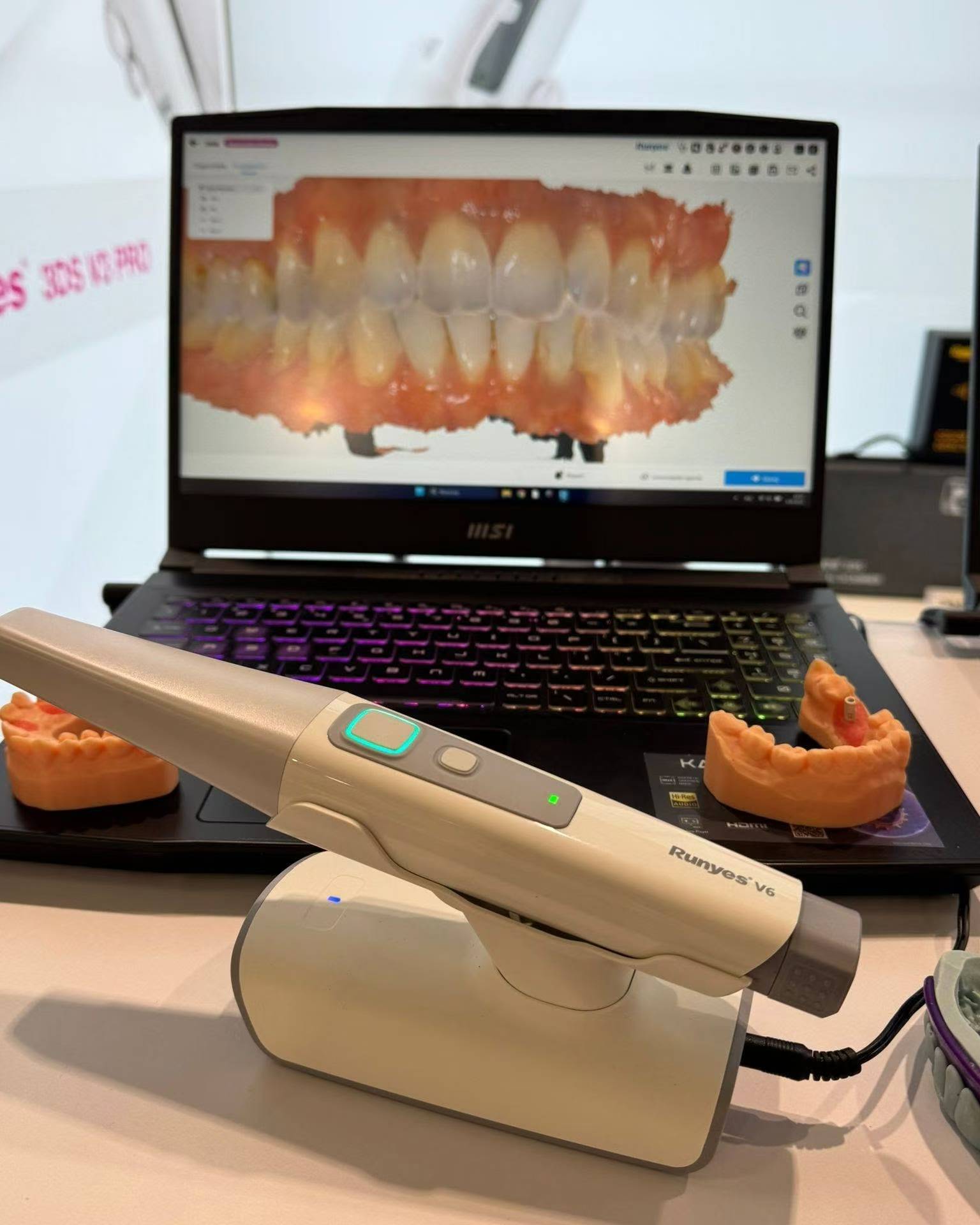 Runyes 3DS V6 Intraoral Scanner｜Focus on Dental Intraoral Scanning